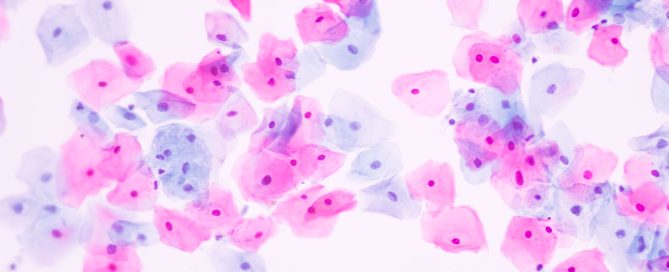 cervical cells from smear test