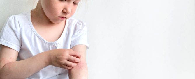 picture of child scratching atopic eczema on her arm